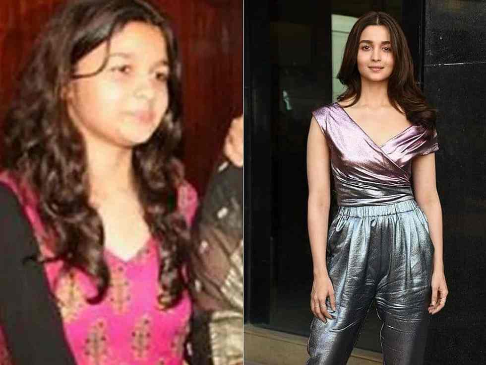  Alia Bhatt reveals her weight reduction weight loss plan secrets and techniques and breaks the largest weight loss plan myths